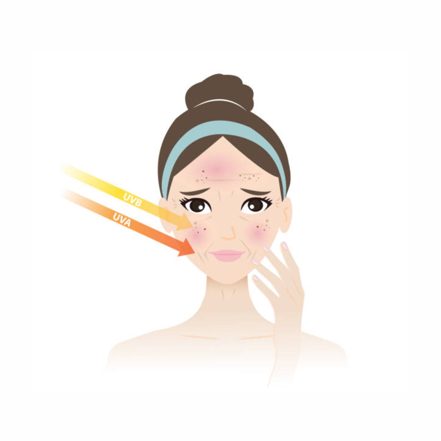 Hyperpigmentation